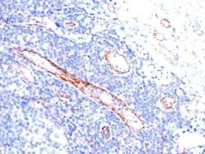 Immunohistochemistry-Paraffin: CD31/PECAM-1 Antibody (C31.3) - IHC-Prediluted [NBP2-44334] - Analysis using the Azide and BSA Free version of CD31/PECAM-1 Antibody (C31.3) - IHC-Prediluted. Staining of human tonsil stained with CD31 MAb (C31.3).