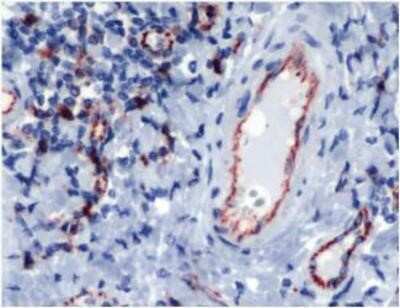 Immunohistochemistry-Paraffin: CD31/PECAM-1 Antibody [NBP1-35530] - Human Tonsil stained with CD31/PECAM-1 Antibody - Pre-diluted.