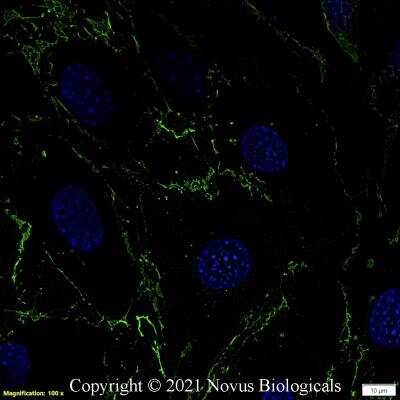 Immunocytochemistry/Immunofluorescence: CD31/PECAM-1 Antibody (MEC 7.46) [Alexa Fluor® 488] [NB100-1642AF488] - Mouse MS1 cells were fixed in 4% paraformaldehyde for 10 minutes and permeabilized in 0.05% Triton X-100 in PBS for 5 minutes. The cells were incubated with CD31/PECAM-1 Antibody [MEC 7.46] conjugated to Alexa Fluor 488 (NB100-1642AF488) at 5 ug/ml for 1 hour at room temperature.  Nuclei were counterstained with DAPI (Blue).  Cells were imaged using a 100X objective and digitally deconvolved.