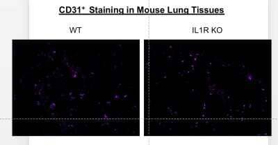 Immunohistochemistry-Frozen: CD31/PECAM-1 Antibody (MEC 7.46) [Alexa Fluor® 647] [NB100-1642AF647] - CD31/PECAM-1 Antibody (MEC 7.46) [Alexa Fluor(R) 647] [NB100-1642AF647] - Frozen mouse lung tissues of WT B6 and IL1R--/- (knockout) mice were blocked with 1% BSA in PBS and were double stained with Alex647-conjugated CD31/PECAM-1 antibody (MEC 7.46) and PE-conjugated F4/80 for 2 hours at the room temperature.