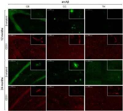 Immunohistochemistry: CD31/PECAM-1 Antibody (MEC 7.46) - Azide and BSA Free [NBP2-80639] - Immunohistochemistry for vessel staining (CD31) and beta-amyloid comparing 13- and 24-month old arcAbeta mice. Overviews (scale bars = 200 um) of the corpus callosum (CC), thalamus (TH), and cerebellum (CB). Insets show the regions with higher magnificati