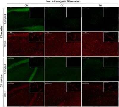 Immunohistochemistry: CD31/PECAM-1 Antibody (MEC 7.46) - Azide and BSA Free [NBP2-80639] - Immunohistochemistry for vessel staining (CD31/PECAM-1) and beta-amyloid comparing 13- and 24-month old non-transgenic littermates. Overviews (scale bars = 200 um) of the corpus callosum (CC), thalamus (TH), and cerebellum (CB). Insets show the regions wi