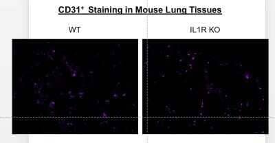 Immunohistochemistry: CD31/PECAM-1 Antibody (MEC 7.46) - Azide and BSA Free [NBP2-80639] - Frozen mouse lung tissues of WT B6 and IL1R--/- (knockout) mice were blocked with 1% BSA in PBS and were double stained with Alex647-conjugated CD31/PECAM-1 antibody (MEC 7.46) and PE-conjugated F4/80 for 2 hours at the room temperature. Image using the A