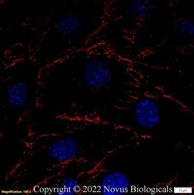 Immunocytochemistry/Immunofluorescence: CD31/PECAM-1 Antibody (MEC 7.46) [DyLight 550] [NB100-1642R] - Mouse MS1 cells were fixed in 4% paraformaldehyde for 10 minutes and permeabilized in 0.05% Triton X-100 in PBS for 5 minutes. The cells were incubated with CD31/PECAM-1 Antibody [MEC 7.46] conjugated to DyLight 550 (NB100-1642R) at 5 ug/ml for 1 hour at room temperature.  Nuclei were counterstained with DAPI (Blue).  Cells were imaged using a 100X objective and digitally deconvolved.