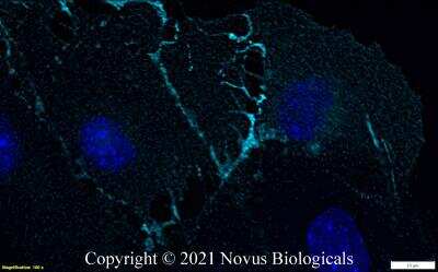 Immunocytochemistry/Immunofluorescence: CD31/PECAM-1 Antibody (MEC13.3) [Alexa Fluor® 647] [NB600-1475AF647] - Mouse MS1 cells were fixed in 4% paraformaldehyde for 10 minutes and permeabilized in 0.05% Triton X-100 in PBS for 5 minutes. The cells were incubated with CD31/PECAM-1 Antibody [MEC13.3] conjugated to Alexa Fluor 647 (NB600-1475AF647) at 5 ug/ml for 1 hour at room temperature.  Nuclei were counterstained with DAPI (Blue).  Cells were imaged using a 100X objective and digitally deconvolved.