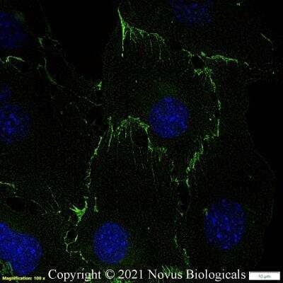 Immunocytochemistry/Immunofluorescence: CD31/PECAM-1 Antibody (MEC13.3) [DyLight 488] [NB600-1475G] - Mouse MS1 cells were fixed in 4% paraformaldehyde for 10 minutes and permeabilized in 0.05% Triton X-100 in PBS for 5 minutes. The cells were incubated with CD31/PECAM-1 Antibody [MEC13.3] conjugated to DyLight 488 (NB600-1475G) at 5 ug/ml for 1 hour at room temperature.  Nuclei were counterstained with DAPI (Blue).  Cells were imaged using a 100X objective and digitally deconvolved.