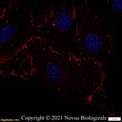 Immunocytochemistry/Immunofluorescence: CD31/PECAM-1 Antibody (MEC13.3) [DyLight 550] [NB600-1475R] - Mouse MS1 cells were fixed in 4% paraformaldehyde for 10 minutes and permeabilized in 0.05% Triton X-100 in PBS for 5 minutes. The cells were incubated with CD31/PECAM-1 Antibody [MEC13.3] conjugated to DyLight 550 (NB600-1475R) at 5 ug/ml for 1 hour at room temperature.  Nuclei were counterstained with DAPI (Blue).  Cells were imaged using a 100X objective and digitally deconvolved.