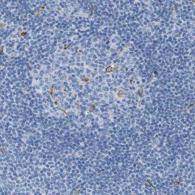 Immunohistochemistry-Paraffin CD320/TCblR/8D6A Antibody - BSA Free