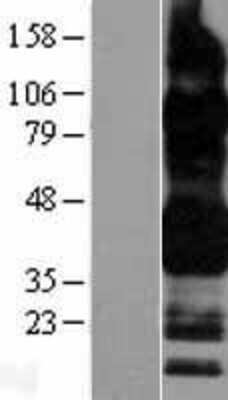 Western Blot: CD32B/Fc-gamma RII-b Overexpression Lysate (Adult Normal) [NBL1-10656] Left-Empty vector transfected control cell lysate (HEK293 cell lysate); Right -Over-expression Lysate for CD32B/Fc-gamma RII-b.