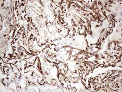 Immunohistochemistry: CD34 Antibody (11E1) [NBP2-46144] - Analysis of Human lung tissue within the normal limits using CD34 mouse monoclonal antibody.(Heat-induced epitope retrieval by 1mM EDTA in 10mM Tris buffer (pH8.5) at 120C for 3 min)