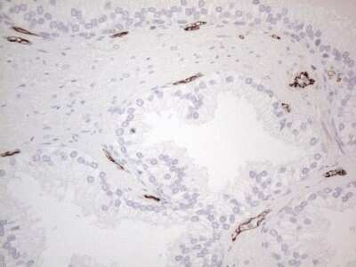 Immunohistochemistry: CD34 Antibody (11E1) [NBP2-46144] - Analysis of Human prostate tissue. (Heat-induced epitope retrieval by 1mM EDTA in 10mM Tris buffer (pH8.5) at 120C for 3 min)