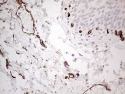 Immunohistochemistry: CD34 Antibody (11E1) [NBP2-46144] - Analysis of Human bladder tissue. (Heat-induced epitope retrieval by 1mM EDTA in 10mM Tris buffer (pH8.5) at 120C for 3 min)(1:150)