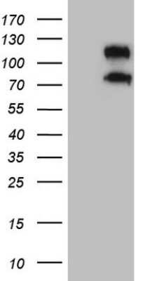 Western Blot: CD34 Antibody (11E1) [NBP2-46144] - Analysis of HEK293T cells were transfected with the pCMV6-ENTRY control (Left lane) or pCMV6-ENTRY CD34.