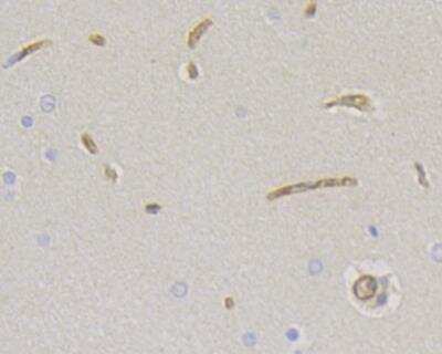 Immunohistochemistry-Paraffin: CD34 Antibody (15H1) [NBP2-89157] - Analysis of paraffin-embedded rat brain tissue using anti-CD34 antibody. The section was pre-treated using heat mediated antigen retrieval with Tris-EDTA buffer (pH 8.0-8.4) for 20 minutes.The tissues were blocked in 5% BSA for 30 minutes at room temperature, washed with ddH2O and PBS, and then probed with the primary antibody( 1/50) for 30 minutes at room temperature. The detection was performed using an HRP conjugated compact polymer system. DAB was used as the chromogen. Tissues were counterstained with hematoxylin and mounted with DPX.