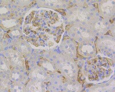 Immunohistochemistry-Paraffin: CD34 Antibody (15H1) [NBP2-89157] - Analysis of paraffin-embedded rat kidney tissue using anti-CD34 antibody. The section was pre-treated using heat mediated antigen retrieval with Tris-EDTA buffer (pH 8.0-8.4) for 20 minutes.The tissues were blocked in 5% BSA for 30 minutes at room temperature, washed with ddH2O and PBS, and then probed with the primary antibody( 1/50) for 30 minutes at room temperature. The detection was performed using an HRP conjugated compact polymer system. DAB was used as the chromogen. Tissues were counterstained with hematoxylin and mounted with DPX.