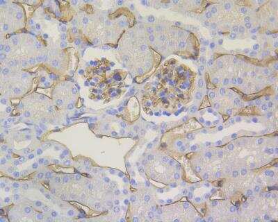 Immunohistochemistry-Paraffin: CD34 Antibody (15H1) [NBP2-89157] - Analysis of paraffin-embedded mouse kidney tissue using anti-CD34 antibody. The section was pre-treated using heat mediated antigen retrieval with Tris-EDTA buffer (pH 8.0-8.4) for 20 minutes.The tissues were blocked in 5% BSA for 30 minutes at room temperature, washed with ddH2O and PBS, and then probed with the primary antibody( 1/200) for 30 minutes at room temperature. The detection was performed using an HRP conjugated compact polymer system. DAB was used as the chromogen. Tissues were counterstained with hematoxylin and mounted with DPX.