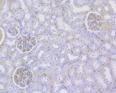 Immunohistochemistry-Paraffin: CD34 Antibody (15H1) [NBP2-89157] - Analysis of paraffin-embedded rat kidney tissue using anti-CD34 antibody. The section was pre-treated using heat mediated antigen retrieval with Tris-EDTA buffer (pH 9.0) for 20 minutes.The tissues were blocked in 1% BSA for 30 minutes at room temperature, washed with ddH2O and PBS, and then probed with the primary antibody (1/200) for 30 minutes at room temperature. The detection was performed using an HRP conjugated compact polymer system. DAB was used as the chromogen. Tissues were counterstained with hematoxylin and mounted with DPX.