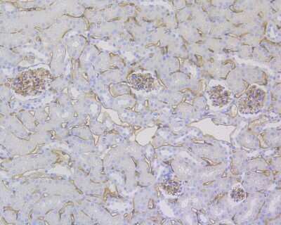 Immunohistochemistry-Paraffin: CD34 Antibody (15H1) [NBP2-89157] - Analysis of paraffin-embedded mouse kidney tissue using anti-CD34 antibody. The section was pre-treated using heat mediated antigen retrieval with Tris-EDTA buffer (pH 9.0) for 20 minutes.The tissues were blocked in 1% BSA for 30 minutes at room temperature, washed with ddH2O and PBS, and then probed with the primary antibody (1/200) for 30 minutes at room temperature. The detection was performed using an HRP conjugated compact polymer system. DAB was used as the chromogen. Tissues were counterstained with hematoxylin and mounted with DPX.