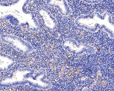 Immunohistochemistry-Paraffin: CD34 Antibody (15H1) [NBP2-89157] - Analysis of paraffin-embedded human endometrium tissue using anti-CD34 antibody. The section was pre-treated using heat mediated antigen retrieval with Tris-EDTA buffer (pH 9.0) for 20 minutes.The tissues were blocked in 1% BSA for 30 minutes at room temperature, washed with ddH2O and PBS, and then probed with the primary antibody (1/400) for 30 minutes at room temperature. The detection was performed using an HRP conjugated compact polymer system. DAB was used as the chromogen. Tissues were counterstained with hematoxylin and mounted with DPX.