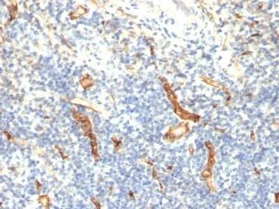 Immunohistochemistry-Paraffin: CD34 Antibody (HPCA1/1171) - Azide and BSA Free [NBP2-47911] - Human Tonsil stained with CD34 Monoclonal Antibody (HPCA1/1171)