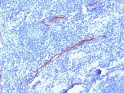 Immunohistochemistry-Paraffin: CD34 Antibody (HPCA1/1806R) - Azide and BSA Free [NBP2-54355] - Formalin-fixed, paraffin-embedded human Tonsil stained with CD34 Recombinant Rabbit Monoclonal Antibody (HPCA1/1806R)