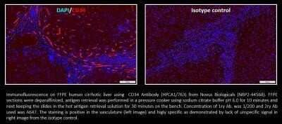 Immunocytochemistry/Immunofluorescence: CD34 Antibody (HPCA1/763) - Azide and BSA Free [NBP2-47910] - This image was submitted via customer review.