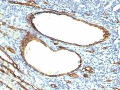 Immunohistochemistry-Paraffin: CD34 Antibody (HPCA1/763) - Azide and BSA Free [NBP2-47910] - Human Tonsil stained with CD34 Monoclonal Antibody (HPCA1/763)