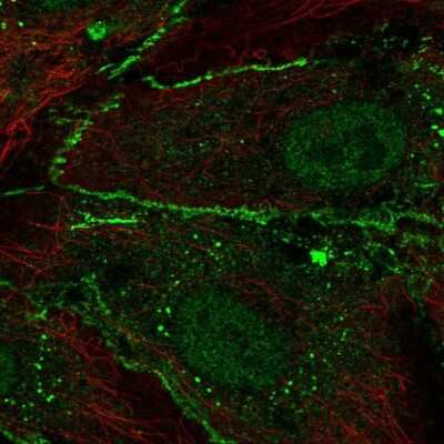 <b>Orthogonal Strategies Validation. </b>Immunocytochemistry/Immunofluorescence: CD34 Antibody [NBP2-38322] - Staining of human cell line HUVEC TERT2 shows localization to nucleoplasm & cell junctions. Antibody staining is shown in green.