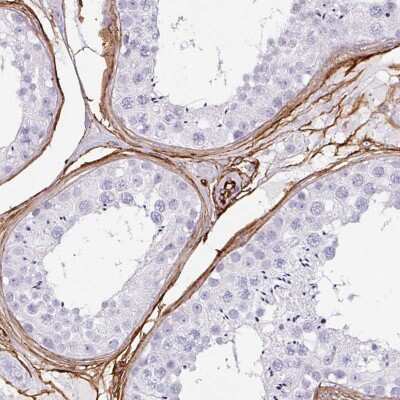 Immunohistochemistry-Paraffin: CD34 Antibody [NBP2-38321] - Staining of human testis shows moderate to strong membranous positivity in endothelial cells.