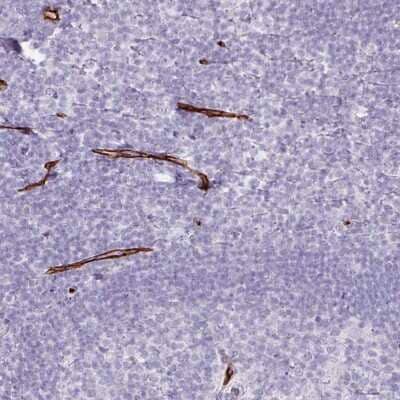 Immunohistochemistry-Paraffin: CD34 Antibody [NBP2-38321] - Staining of human tonsil shows moderate to strong membranous positivity in endothelial cells.