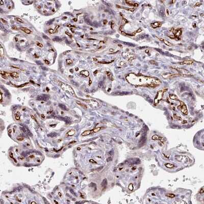 Immunohistochemistry-Paraffin: CD34 Antibody [NBP2-38322] - Staining of human placenta shows moderate to strong membranous positivity in endothelial cells.