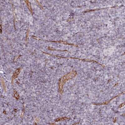 Immunohistochemistry-Paraffin: CD34 Antibody [NBP2-38322] - Staining of human tonsil shows moderate to strong membranous positivity in endothelial cells.