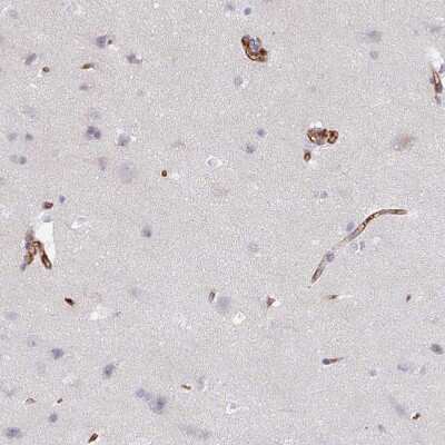 Immunohistochemistry-Paraffin: CD34 Antibody [NBP2-38322] - Staining of human cerebral cortex shows moderate membranous positivity in endothelial cells and very weak cytoplasmic positivity in neurons.