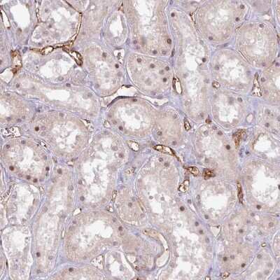 Immunohistochemistry-Paraffin: CD34 Antibody [NBP2-38322] - Staining of human kidney shows moderate membranous positivity in endothelial cells.