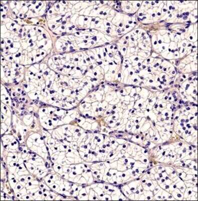 Immunocytochemistry: CD34 Antibody (MEC 14.7) - Azide and BSA Free [NBP2-80642] - Analysis of a human renal cancer tissue section using CD34 antibody (clone MEC 14.7) at 1:100 dilution. The antibody did not detect human CD34 which is an expected outcome for this clone. This section was included in NB600-1071's IHC validation testing as