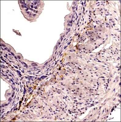 Immunohistochemistry: CD34 Antibody (MEC 14.7) - Azide and BSA Free [NBP2-80642] - Analysis of a FFPE tissue section of mouse colon using rat anti-mouse CD34 (clone MEC 14.7) at 1:100 dilution. The signal was developed using HRP-conjugated anti-rat secondary with DAB reagent which followed counterstaining of nuclei using hematoxylin. Th