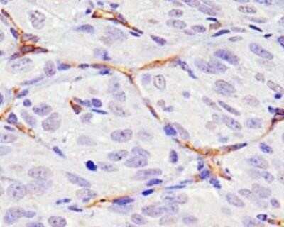 Immunohistochemistry: CD34 Antibody (MEC 14.7) - Azide and BSA Free [NBP2-80642] - Analysis of CD34 on human renal cancer xenograft using CD34 antibody (clone MEC 14.7). The antibody detected the endothelial cells in the tumor vasculature which are originating from the host (mouse). Image from the standard format of this antibody.