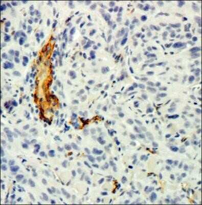 Immunohistochemistry-Paraffin: CD34 Antibody (MEC 14.7) - Azide and BSA Free [NBP2-80642] - Analysis of a FFPE tissue section of human renal cancer xenograft using CD34 antibody (clone MEC 14.7) at 1:100 dilution. The staining was detected using HRP-conjugated secondary antibody and DAB reagent followed by counterstaining of nuclei with hematoxy