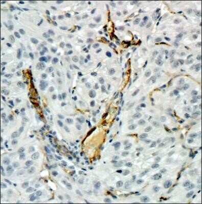 Immunohistochemistry-Paraffin: CD34 Antibody (MEC 14.7) - Azide and BSA Free [NBP2-80642] - Analysis of a FFPE tissue section of human renal cancer xenograft using CD34 antibody clone MEC 14.7 at 1:100 dilution. The signal was developed using HRP-conjugated secondary antibody and DAB reagent followed by counterstaining of nuclei with hematoxylin