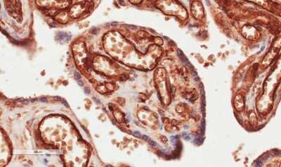 Immunohistochemistry: CD34 Antibody (My10) - Chimeric [NBP2-62554] - Immunohistochemical staining of human placenta tissue using anti-CD34 antibody. My10 Anti-CD34 staining of paraffin embedded human placenta tissue using the rabbit-chimeric version of My10 (NBP2-62554). Antigen retreival was acheived by microwaving in citrate buffer (pH6), followed by blocking with protein block serum-free buffer. Primary antibody incubation with NBP2-62554 was carried out at 4 ug/ml for 30 minutes. Samples were then incubated with an anti-rabbit IgG HRP secondary antibody for 20 mins followed by DAB (3,3'-diaminobenzidine), and counter-staining with haemotoxylin. Strong endothelial staining of within villi may be observed. Recommended concentration, 2-4 ug/ml.