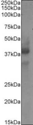 Western Blot: CD34 Antibody (My10) - Chimeric [NBP2-62554] - Western Blot using anti-CD34 antibody My10. Jurkat cell extract (35ug protein in RIPA buffer) was resolved on a 10% SDS PAGE gel and blots probed with the chimeric rabbit version of My10 (NBP2-62554) at 0.1 ug/ml before detection using an anti-rabbit secondary antibody. A primary incubation of 1h was used and protein was detected by chemiluminescence. The expected band size for the canonical isoform of CD34 is 40.9kDa, though a second isoform at 35.2kDa is also present, with a 56 amino acid truncation at the C-terminus of the protein (Uniprot ID: Q64314). CD34 is also glycosylated at several positions. NBP2-62554 successfully detected both isoforms of human CD34.