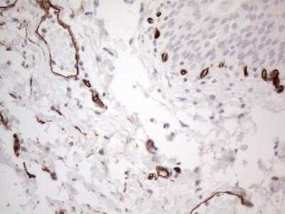 Immunohistochemistry: CD34 Antibody (OTI11E1) - Azide and BSA Free [NBP2-70375] - Analysis of Human bladder tissue. (Heat-induced epitope retrieval by 1mM EDTA in 10mM Tris buffer (pH8.5) at 120C for 3 min)(1:150)