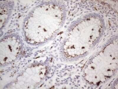 Immunohistochemistry: CD34 Antibody (OTI11E1) - Azide and BSA Free [NBP2-70375] - Analysis of Human colon tissue. (Heat-induced epitope retrieval by 1mM EDTA in 10mM Tris buffer (pH8.5) at 120C for 3 min)