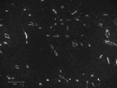 Immunohistochemistry-Paraffin: CD34 Antibody (QBEnd/10 + HPCA1/763) - Azide and BSA Free [NBP2-47909] - Human tonsil. Antigen retrieval at pH 9. IF with Cy3 conjugate. Image from verified customer review.