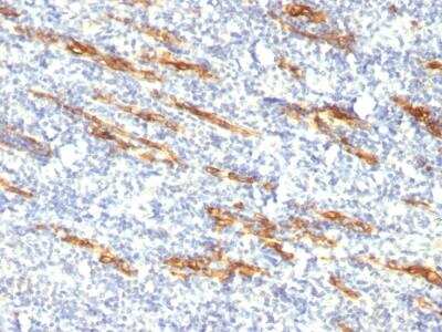 Immunohistochemistry-Paraffin: CD34 Antibody (QBEnd/10 + HPCA1/763) - IHC-Prediluted [NBP2-48362] - Formalin-fixed, paraffin-embedded human Tonsil stained with CD34 Monoclonal Antibody (QBE.nd/10 + HPCA1/763)