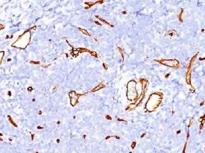 Immunohistochemistry-Paraffin: CD34 Antibody (SPM123) - Azide and BSA Free [NBP2-34733] - Formalin-fixed paraffin-embedded human tonsil stained with CD34 Monoclonal Antibody (SPM123)