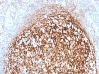 Immunohistochemistry-Paraffin: CD35 Antibody (CR1/4382R) - Azide and BSA Free [NBP3-08296] - Formalin-fixed, paraffin-embedded human tonsil stained with CD35 Recombinant Rabbit Monoclonal Antibody (CR1/4382R).