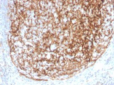 Immunohistochemistry-Paraffin: CD35 Antibody (CR1/4382R) - Azide and BSA Free [NBP3-08296] - Formalin-fixed, paraffin-embedded human tonsil stained with CD35 Recombinant Rabbit Monoclonal Antibody (CR1/4382R).