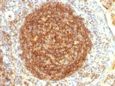 Immunohistochemistry-Paraffin CD35 Antibody (CR1/802) - Azide and BSA Free