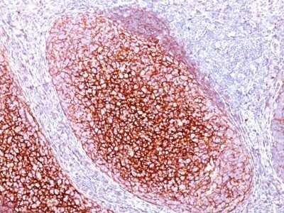 Immunohistochemistry-Paraffin: CD35 Antibody (CR1/802) - Azide and BSA Free [NBP2-47865] - Human Tonsil stained with CD35 Monoclonal Antibody (CR1/802).